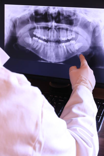 Best Dental Abscess Treatment in Ackerman, MS