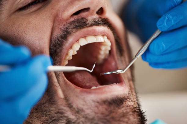 Best Emergency Treatment for Oral Infections in Ackerman, MS