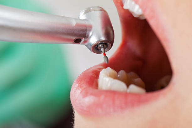 Best Emergency Dental Care for Sports Injuries in Ackerman, MS